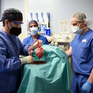  美国成功进行全球首起 猪心移植人体手术